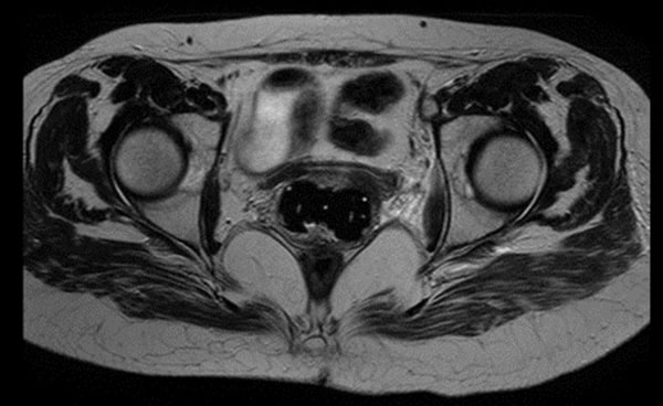 MR imaging